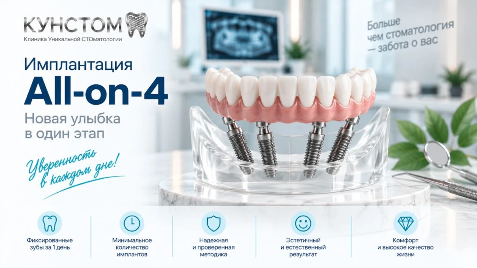 Имплантация All-on-4 в клинике Кунстом — новая улыбка в один этап