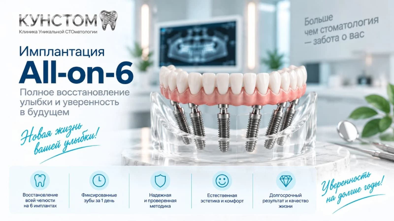 Имплантация All-on-6 в клинике Кунстом — полное восстановление улыбки